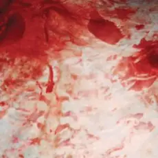 Обложка: Salem - Baby Ratta