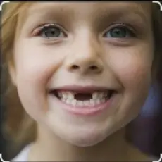 Обложка: unknown - Мишка Билерман